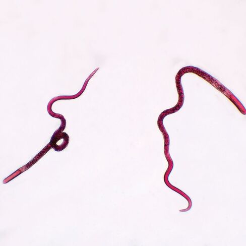 Trichinella Spiralis Female Slide, W.M. in Kuwait