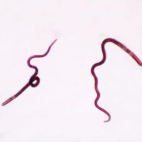 Trichinella Spiralis Female Slide, W.M. in Kuwait
