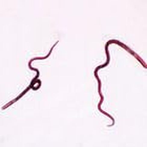 Trichinella Spiralis Female Slide, W.M. in Kuwait