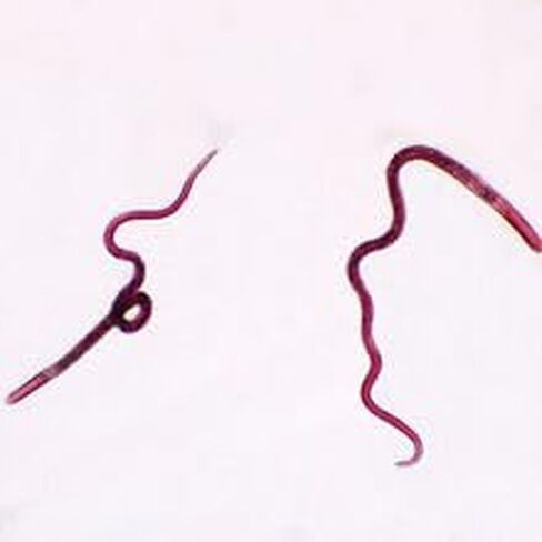 Trichinella Spiralis Female Slide, W.M. in Kuwait