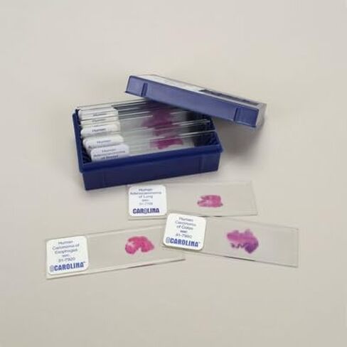 Malignant Tissues Microscope Slide Set in Kuwait