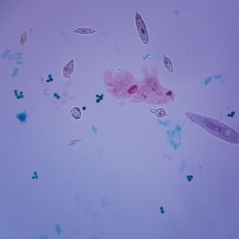 Mixed Protists, W.M. Microscope Slide in Kuwait