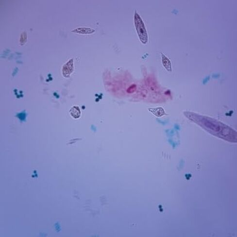 Mixed Protists, W.M. Microscope Slide in Kuwait