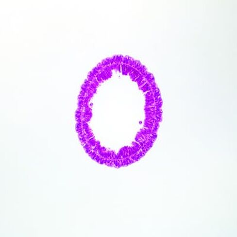 Hydra, C.S. H&E Microscope Slide in Kuwait
