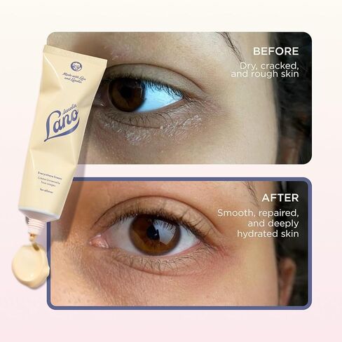 Lanolips Everywhere Cream - فائق الترطيب فيتامين E & Lanolin غسول الجسم ومرطب للوجه للبشرة الجافة والمتصدع - العناية بالبشرة والعناية بالجسم للأطفال والرضع (85 مل / 2.9 أوقية) in Kuwait