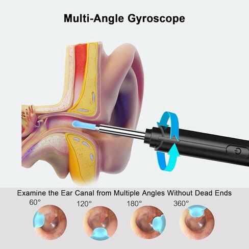 إزالة شمع الأذن، منظف الأذن مع كاميرا عالية الدقة 1296 بكسل، مجموعة تنظيف شمع الأذن مع 6 ملاعق أذن، أداة إزالة شمع الأذن مع مجموعة 8 قطع، كاميرا أذن لأجهزة iOS وiPadOS وAndroid (أسود) in Kuwait