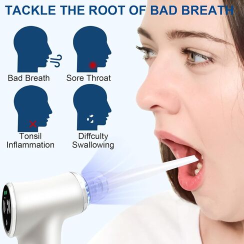 Tonsil Stone Vacuum Removal Kit with LED Light - Electronic Tonsil Stone Remover Tool with 6 Levels Suction, Shadowless Light, 5 Silicone Nozzles, Tweezers, Tough Plate, Swabs, 5X Magnifying Mirror in Saudi Arabia