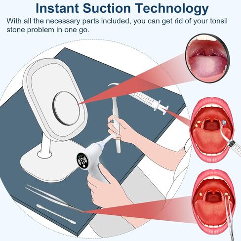 Tonsil Stone Vacuum Removal Kit with LED Light - Electronic Tonsil Stone Remover Tool with 6 Levels Suction, Shadowless Light, 5 Silicone Nozzles, Tweezers, Tough Plate, Swabs, 5X Magnifying Mirror in Saudi Arabia