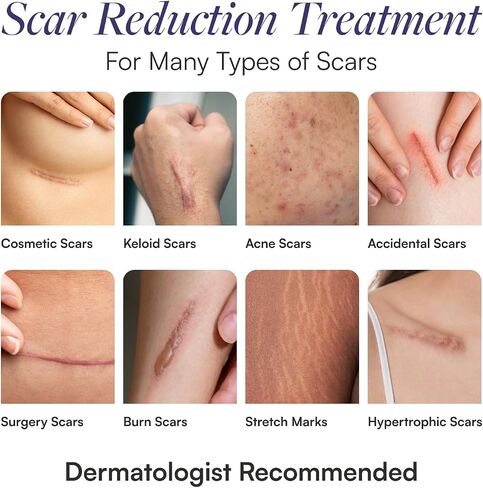 Skintensive Silicone Scar Gel - Scar Cream for Surgical Scars, Burns, Stretch Marks, Acne & Keloids [Packaging May Vary] in Saudi Arabia