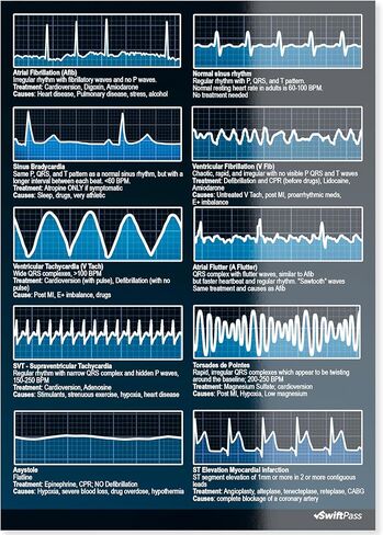 EKG Rhythm Interpretation Dual Sided for Nursing/Medical Students - Pocket ECG/EKG Cheat Card for Exam Study in Kuwait