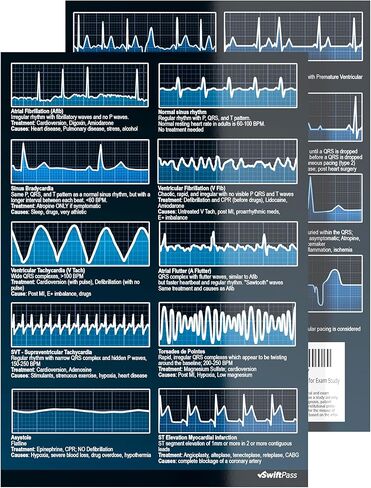 EKG Rhythm Interpretation Dual Sided for Nursing/Medical Students - Pocket ECG/EKG Cheat Card for Exam Study in Kuwait