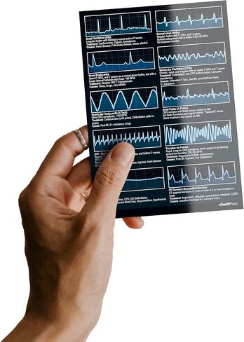 EKG Rhythm Interpretation Dual Sided for Nursing/Medical Students - Pocket ECG/EKG Cheat Card for Exam Study in Kuwait