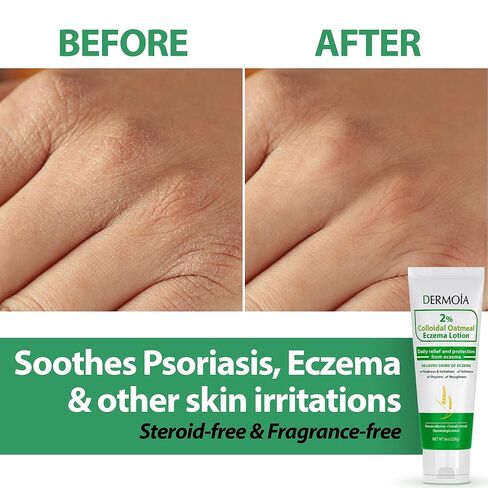 2% Colloidal Oatmeal Eczema Lotion - Soothing & Moisturizing Anti Itch Cream & Body Lotion for Sensitive Skin - Nourishing Eczema Cream for Superior Relief & Protection (8oz) in Saudi Arabia