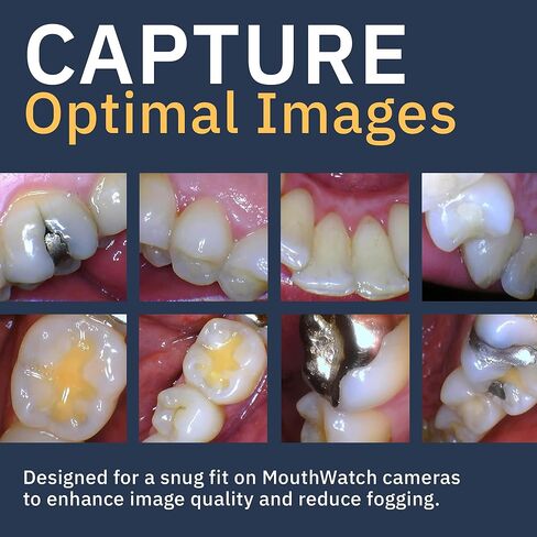 أكمام كاميرا MouthWatch OptiClear™ داخل الفم، مريحة وواضحة بصريًا - غمد الكاميرا لكاميرات الفم داخل الفم، غلاف الكاميرا داخل الفم - غلاف الأسنان (1000 قطعة) in Saudi Arabia