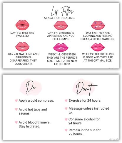 Lip Filler Aftercare Instructions Cards | 50 Pack | 2x3.5 Inch | Business Card Size | Hyaluronic Pen for Spa Esthetician | LEES A.M. in Kuwait