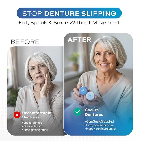 Denture Putty Pack Reline Set - Versatile, Fast Self-Curing - for Custom Fit & Comfort in Dentures, with Multiple Applications & Watertight Seal 2 Pack in Saudi Arabia