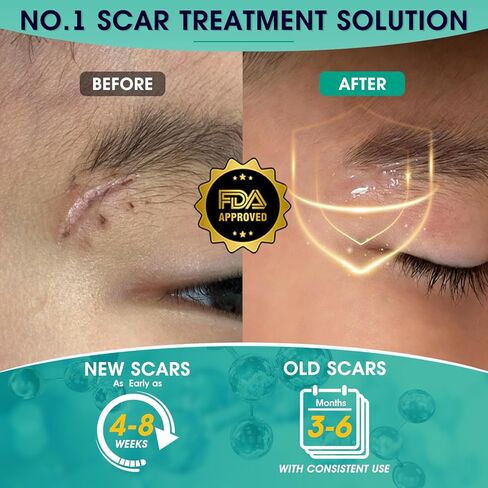 Scar Gel Scar Cream, Keloid Bump Removal, Advance Scar Gel for Surgical Scars,Body,Leg, Burns,C-Section, Stretch Marks, Reduces Discomfort, 0.21oz in Saudi Arabia