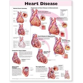 Heart Disease Anatomical Chart