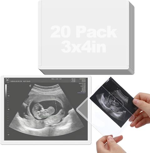 Easy Insert Photo Protector for 3x4in Ultrasound Pictures - Side-Loading to Keep Baby Sonogram Picture/Special Memories Safe, Pregnancy Journal Must Haves, Pregnancy Gifts for Expecting Mom, 20 Pack in Kuwait
