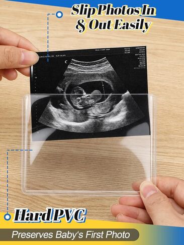 Easy Insert Photo Protector for 3x4in Ultrasound Pictures - Side-Loading to Keep Baby Sonogram Picture/Special Memories Safe, Pregnancy Journal Must Haves, Pregnancy Gifts for Expecting Mom, 20 Pack in Kuwait