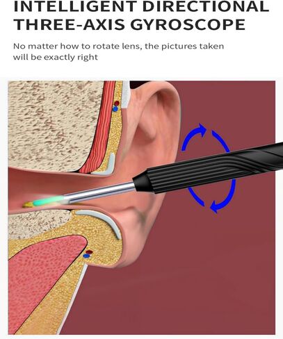 Pro Ear Wax Removal,Soft Silicone Ear Scoop for Ear Cleaning, Ear Cleaner with 1080P HD Otoscope Camera and Light Plus 6Pcs Ear Set for All iPhone and Android Phones. in Saudi Arabia