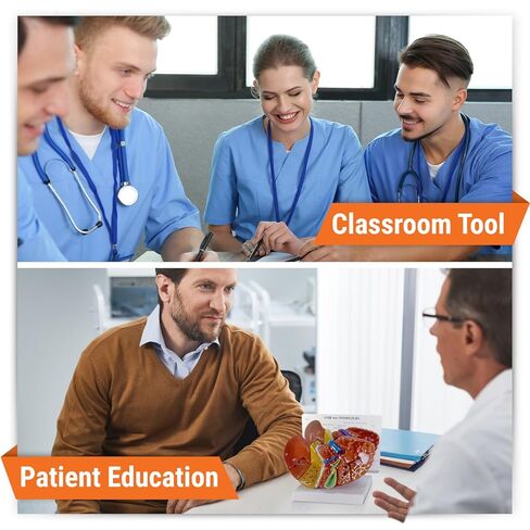 GPI Anatomicals - نموذج الكبد مع الأمراض الشائعة، نسخة طبق الأصل لتعليم التشريح البشري وعلم وظائف الأعضاء، نموذج التشريح لمكاتب الأطباء والفصول الدراسية، مصادر التعلم الطبي in Kuwait