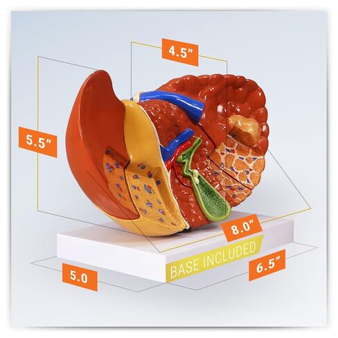 GPI Anatomicals - نموذج الكبد مع الأمراض الشائعة، نسخة طبق الأصل لتعليم التشريح البشري وعلم وظائف الأعضاء، نموذج التشريح لمكاتب الأطباء والفصول الدراسية، مصادر التعلم الطبي in Kuwait