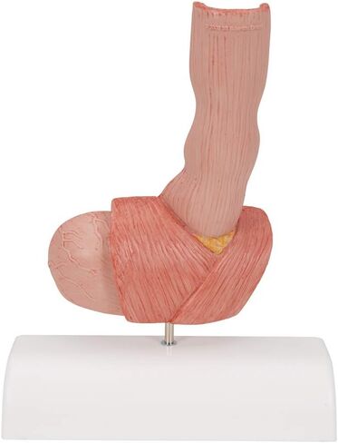 3B Scientific K18 Illnesses of the Esophagus - 3B Smart Anatomy in Saudi Arabia