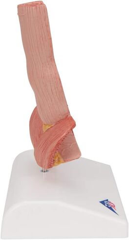 3B Scientific K18 Illnesses of the Esophagus - 3B Smart Anatomy in Saudi Arabia