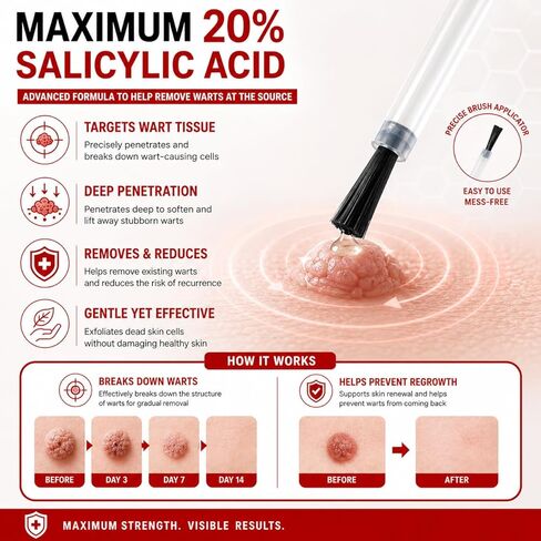 20% Salicylic Acid Wart Remover Liquid, Zero Pain Wart Remover for Plantar, Common, Flat Wart, Foot Corn for Multiple Parts of Body (Pack of 1) in Saudi Arabia