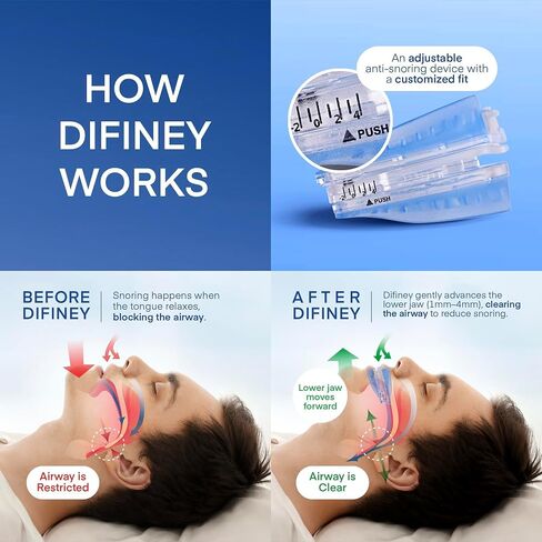 Difiney Anti Snoring Device: FDA-Cleared Anti Snoring Mouthpiece – Adjustable Snore Stopper Mouth Guard for Men & Women to Sleep Better – Reusable Nighttime Use with Storage Case in Kuwait