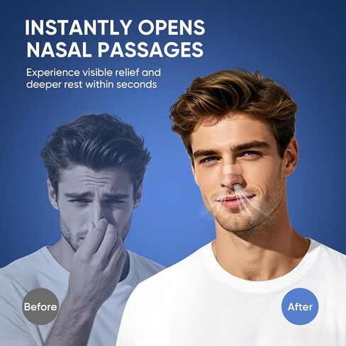 Nasal Strips for Snoring – Comfortable Nose Strips for Breathing,Anti Snoring Devices,Skin-Friendly Snoring Solution for Better Airflow & Restful Sleep in Saudi Arabia