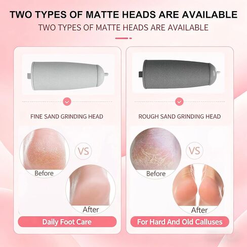 Upgraded Electric Callus Remover for Feet, Rechargeable Portable Foot File with 2-Speeds & 2 Grinding Heads, Waterproof Electric Pedicure Tool for Dry Dead Skin Callus Removal, Foot & Hand Care in Saudi Arabia