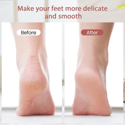ZABOUL Callus Removers for Feet, Electric Foot Callus Remover Rechargeable with 2 Roller Heads Electronic Foot File Removes Hard Skin for Soft Beautiful Feet, Feet Care Pedicure Tools in Saudi Arabia