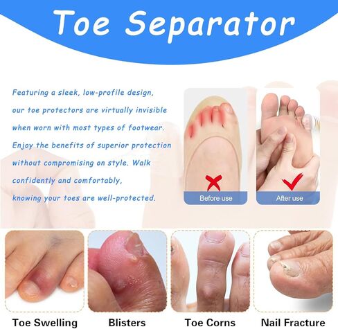 Silicone Anti-Friction Toe Protector, Silicone Toe Protectors, Gel Toe Protectors, Breathable Little Toe Covers, Blisters, Calluses, and Corns Protection (10PC) | Breathable without any foreign sensation in Saudi Arabia