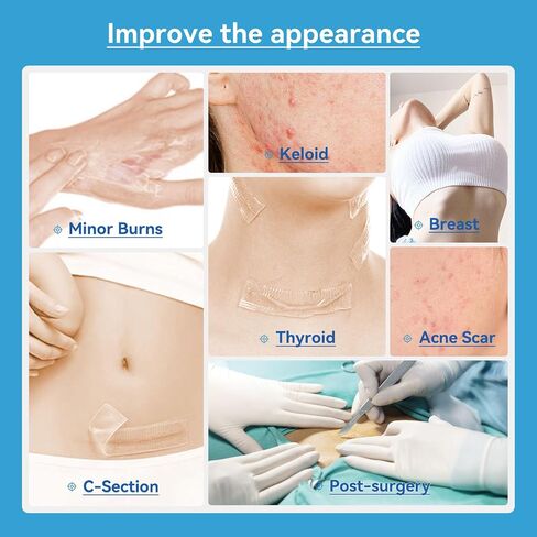 Silicone Scar Sheets - 1.75mm Ultra-Thick & Trimmable, For Old & New Scars from C-Section, Surgery, Keloids, Burns, 4.7" x 5.9" Clear Gel Strips in Saudi Arabia