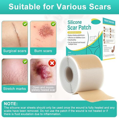 Silicone Scar Sheets(1.6" x 120" Roll-3M), Reusable Silicone Scar Tape for Surgical Scars, C-Section Scars, Stretch Marks, Hypertrophic Scars, Burn Scars, Tummy Tuck and Keloid Scars in Saudi Arabia