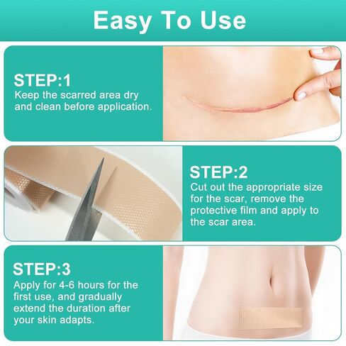 Silicone Scar Sheets(1.6" x 120" Roll-3M), Reusable Silicone Scar Tape for Surgical Scars, C-Section Scars, Stretch Marks, Hypertrophic Scars, Burn Scars, Tummy Tuck and Keloid Scars in Saudi Arabia