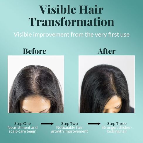 AVD ORGANICS Rosemary Oil for Hair Growth & scalp | Infused with Boitin | Hair Stregthening Nourishing and Volumizing | infused with Jojoba & Castor Oil | NON - GMO 120ml in Saudi Arabia