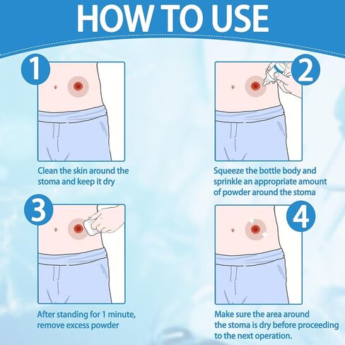 Stoma Powder, 1 oz (30g) Medical Colostomy Skin Barrier Powder, Protective Ostomy Care Supplies Powder for Ileostomy Urostomy, Relief for CGM Glucose Monitor Adhesive Patch Skin Irritation in Saudi Arabia
