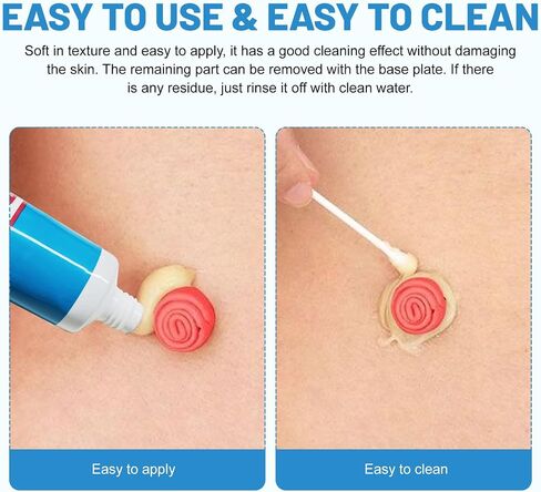 Ostomy Paste Ostomy Supplies, 2 oz Colostomy Skin Barrier Paste, Stomahesive Protective Skin Barrier Paste, Stoma Supplies, Preventing Ostomy Pouch Leakage in Saudi Arabia
