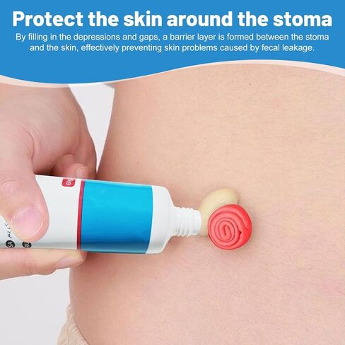 Ostomy Paste Ostomy Supplies, 2 oz Colostomy Skin Barrier Paste, Stomahesive Protective Skin Barrier Paste, Stoma Supplies, Preventing Ostomy Pouch Leakage in Saudi Arabia