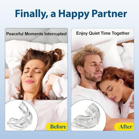 Snore Mouthguard: Anti-Snoring Mouthpiece Sleeping Aid, Comfortable & Reusable Anti Snoring Device for Adults Men & Women(Clear) in Kuwait