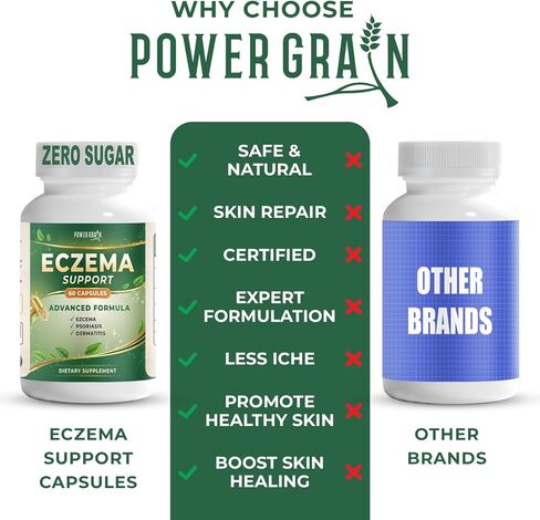 Eczema Support Supplement – Skin Barrier, Redness & Itch Support with Probiotics, Hyaluronic Acid, Curcumin, Quercetin, Zinc & Vitamins C, D3, E – 60 Capsules in Kuwait