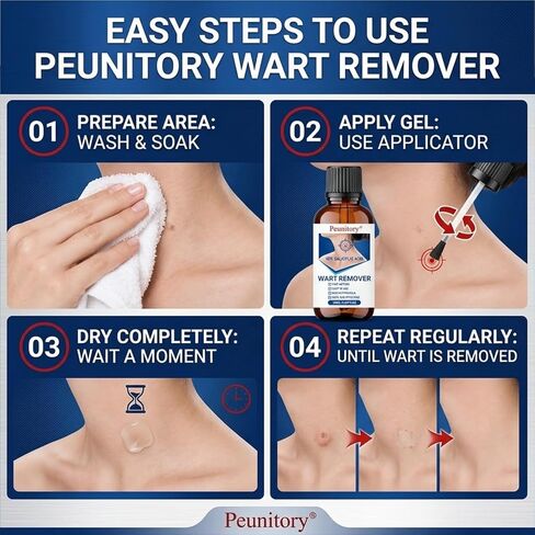 Peunitory 40% Salicylic Acid Wart Remover Liquid, Fast-Acting Maximum Strength Plantar Wart Remover with Natural Herbal Extract for Common Warts & Corns on Hands, Feet, Neck & Body, 1.01 fl oz in Saudi Arabia
