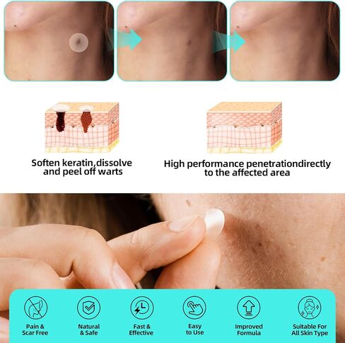 Skin Removal Kit, Effective Skin Removal Kit for Home Use, Safe & Effective for Wart & SkinTags Wart Remover Patches in Saudi Arabia