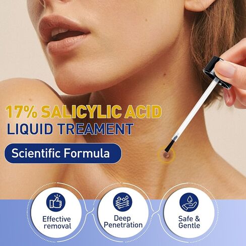 Wart Remover Liquid - Gentle Formula for Plantar Warts, Common & Corn on Feet, Hands and Other External Areas - 17% Salicylic Acid - NET WT: 30ml/ 1fl oz in Kuwait