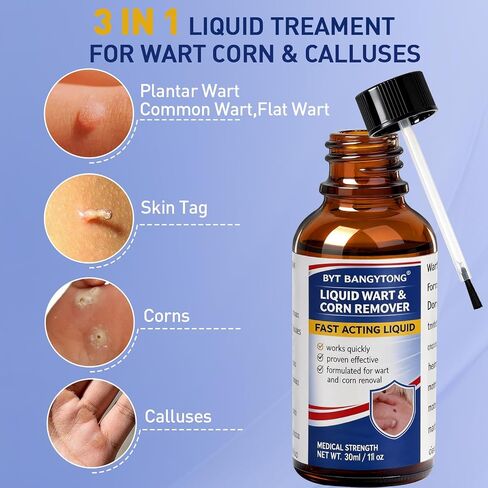 Wart Remover Liquid - Gentle Formula for Plantar Warts, Common & Corn on Feet, Hands and Other External Areas - 17% Salicylic Acid - NET WT: 30ml/ 1fl oz in Kuwait
