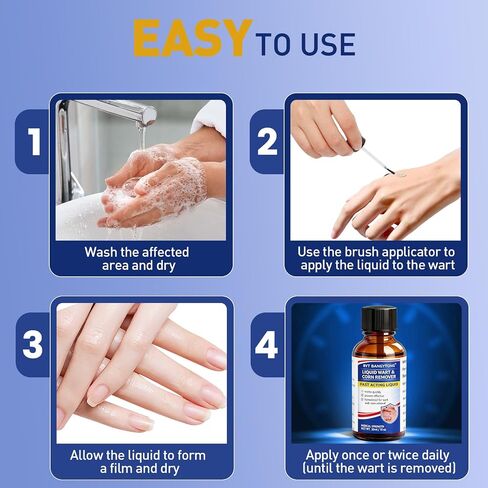Wart Remover Liquid - Gentle Formula for Plantar Warts, Common & Corn on Feet, Hands and Other External Areas - 17% Salicylic Acid - NET WT: 30ml/ 1fl oz in Kuwait