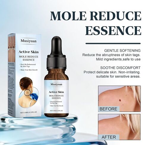 Skin Mole Remover for Hands & Body - Fast Acting Wart Removal with Precision Applicator, Skin Tag Remover for Corns, Mole, Plantar & Common Warts, for Body and Hands(0.33 FL.OZ) in Kuwait